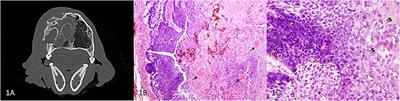 Case Report: Amyloid-Producing Odontogenic Tumor With Pulmonary Metastasis in a Spinone Italiano—Proof of Malignant Potential